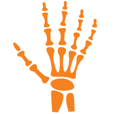 Rheumatoid Arthritis Treatment in Calicut Kerala