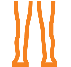Vasculitis Treatment in Calicut Kerala