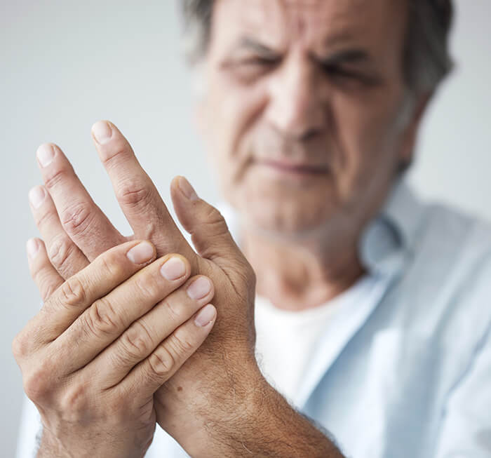Arthritis Treatment in Calicut Kerala