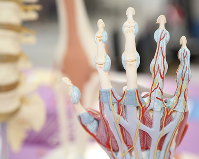 Ankylosing Spondylitis Arthritis Treatment in Calicut Kerala