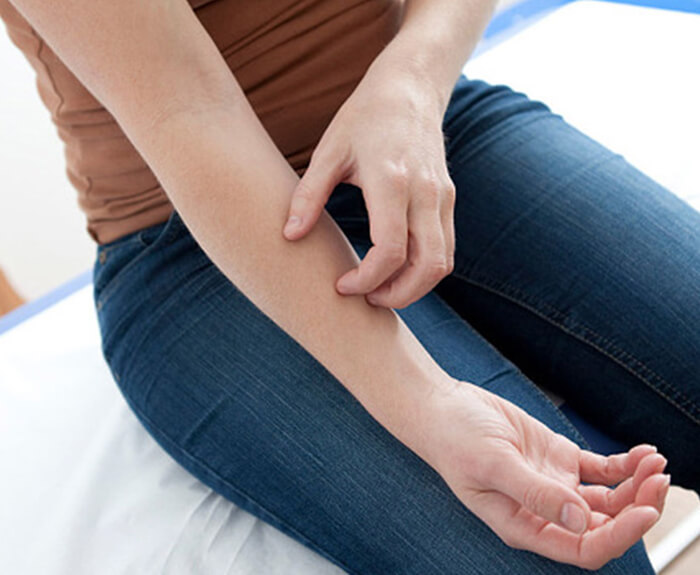 Scleroderma Treatment in Calicut Kerala